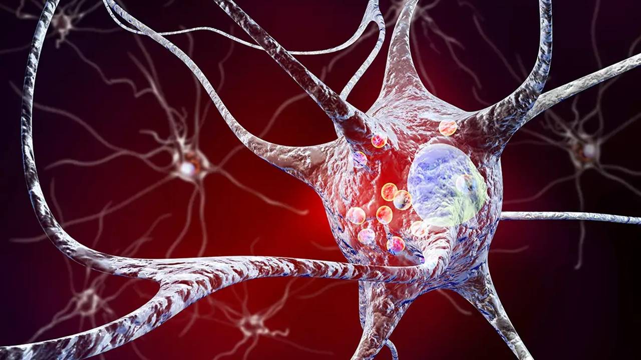 Buzul Suyu - Parkinson Hastalığı Risk