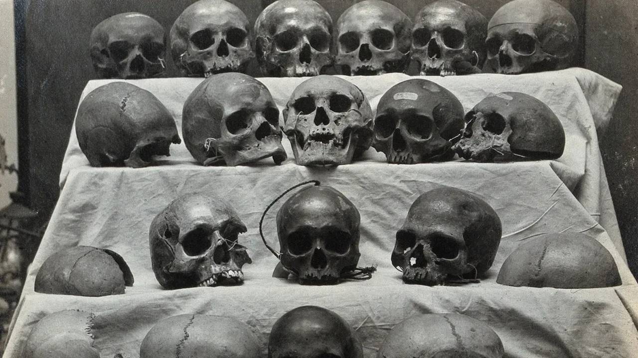 İnsan Kafatası Şekli Son 100 Yıl Değişim